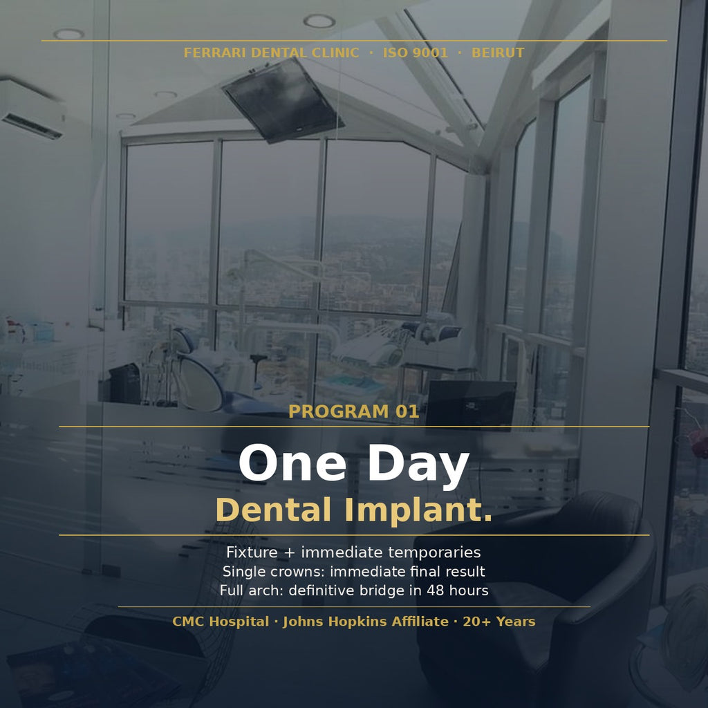 One Day Dental Implant — Beirut by Smile Infinity®