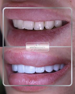 Smile Infinity VIP All-Inclusive Experience — Beirut