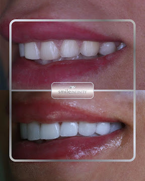 Smile Infinity VIP All-Inclusive Experience — Beirut